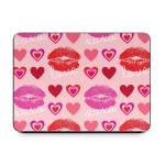 Love Hugs Kisses Smart Keyboard Folio for iPad Series Skin