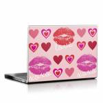 Love Hugs Kisses Laptop Skin
